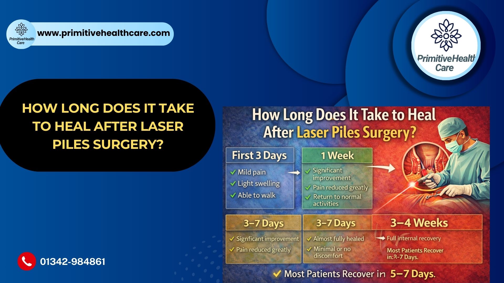 How Long Does It Take to Heal After Laser Piles Surgery?